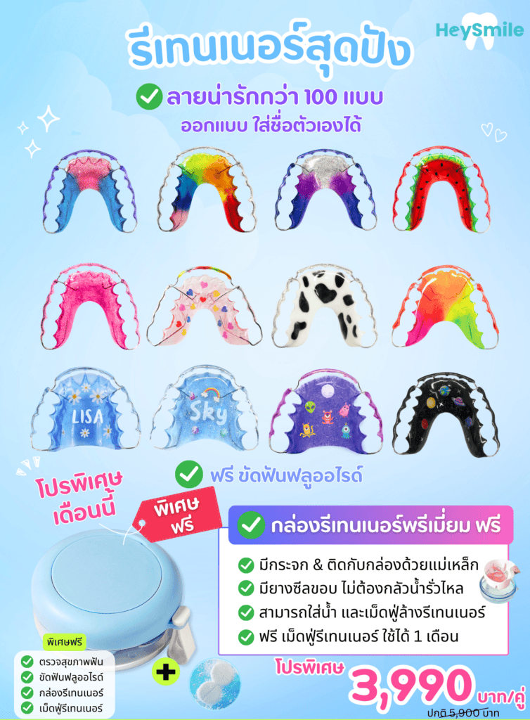 Retainer รีเทนเนอร์ 1 e1731731861137