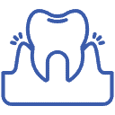 gingivitis