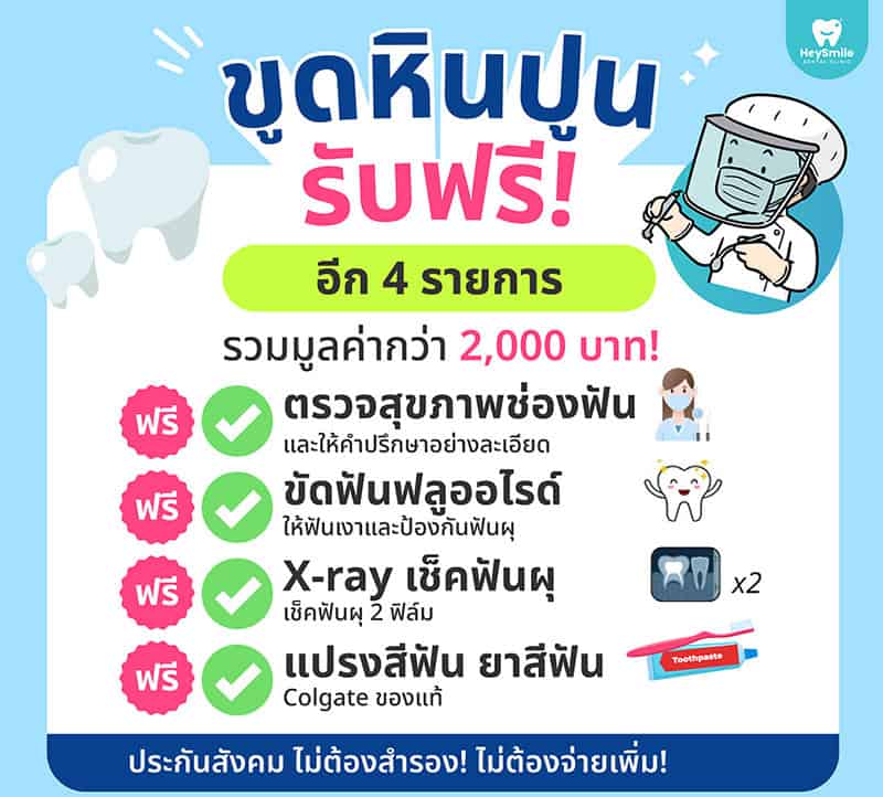 ขูดหินปูน ประกันสังคม small
