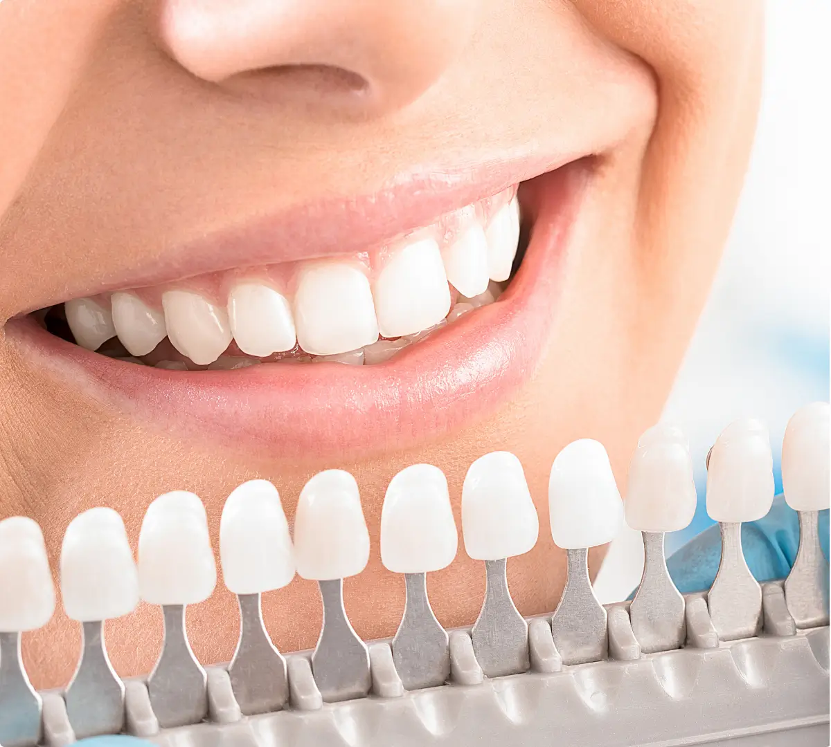 Dental services Bangkok Whitening