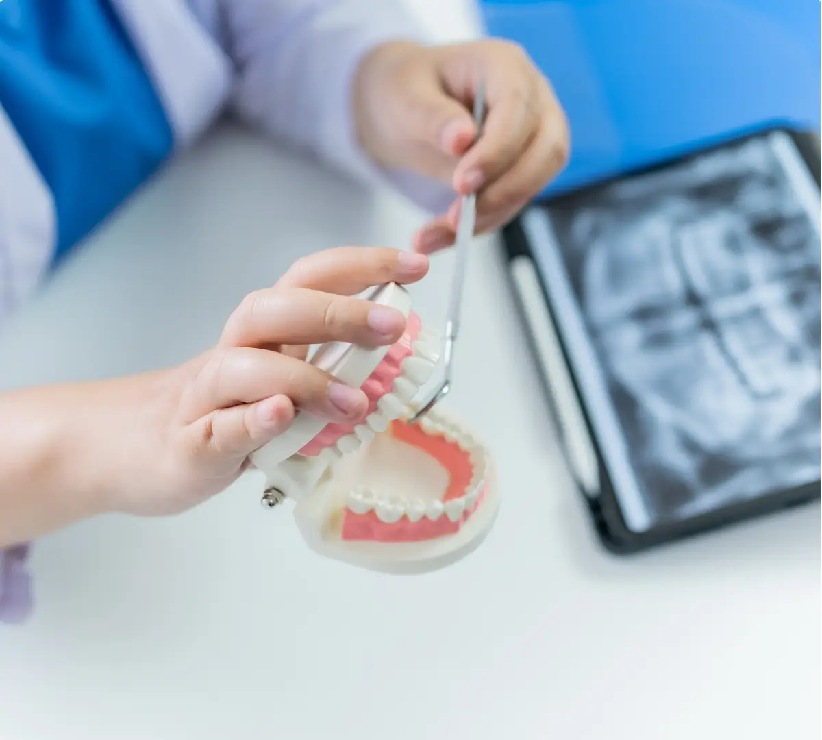 Dental services -Root Canal Treatment