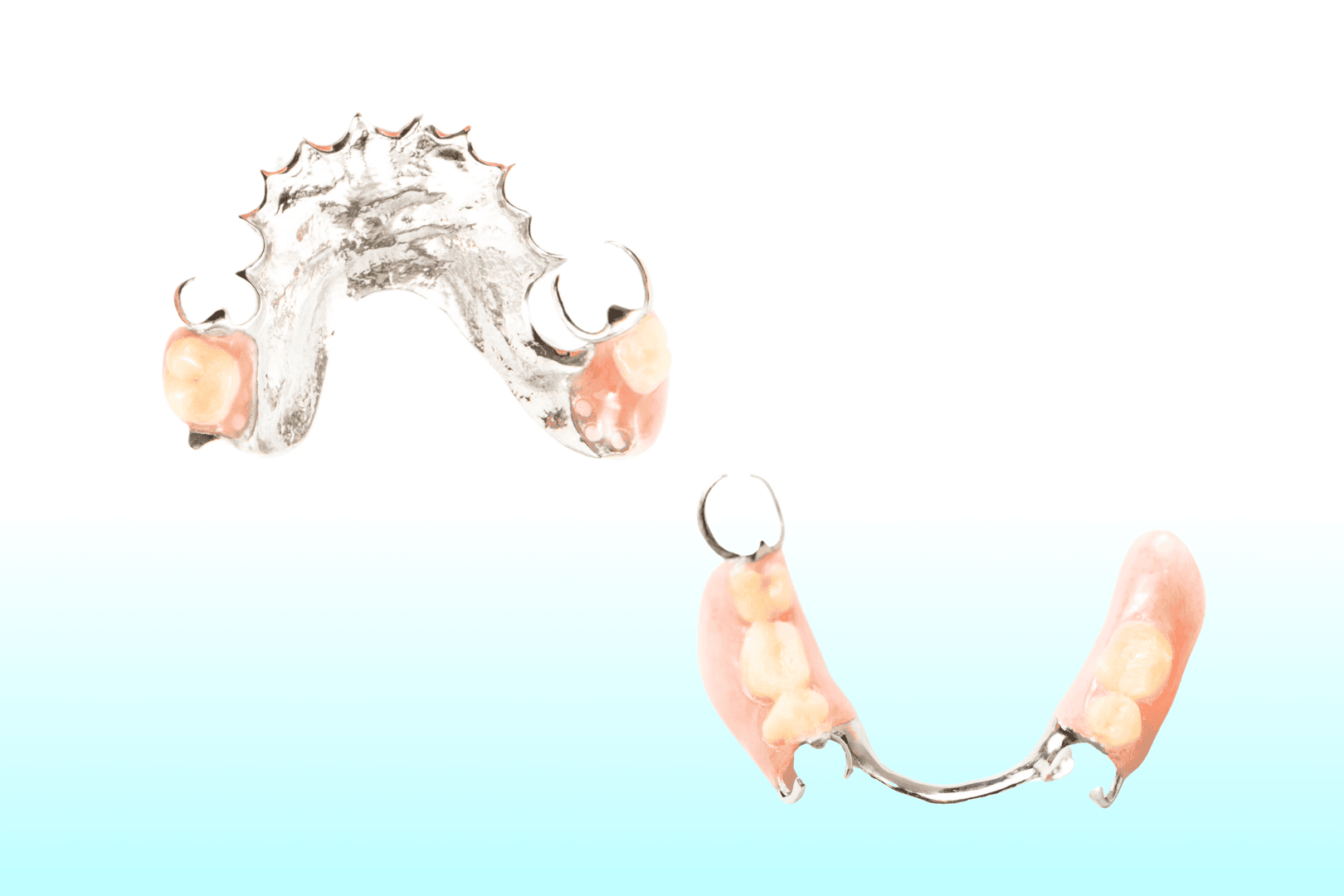 Metal Based Dentures