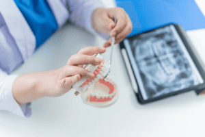 การเตรียมตัวก่อนการรักษารากฟัน