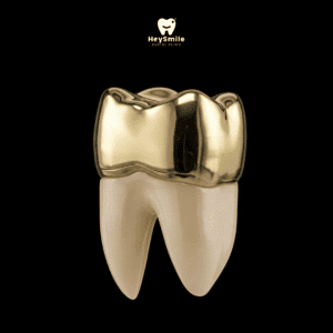 ครอบฟันจากโลหะ Full Metal Crown