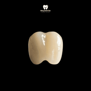 ครอบฟันเซรามิก All Ceramic Crown