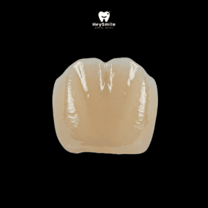 ครอบฟันเรซิน All Resin Crown
