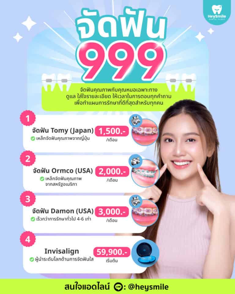 จัดฟัน ที่ไหนดี คำแนะนำจาก คลินิกทันตกรรมเฮย์สไมล์