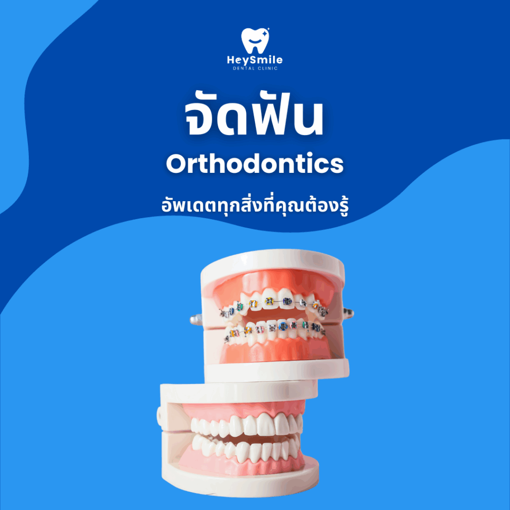 จัดฟัน ใกล้ฉัน