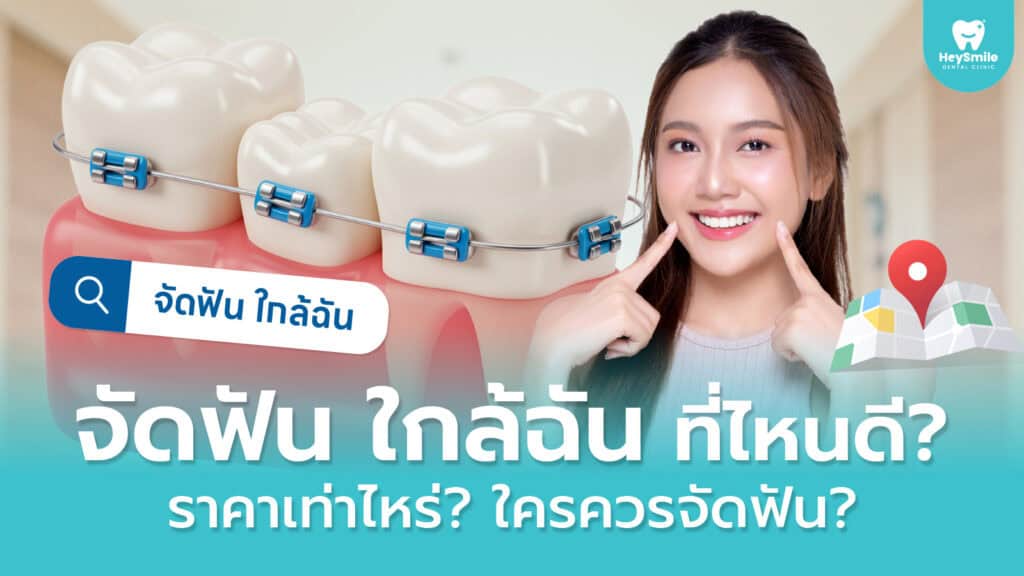 จัดฟัน ใกล้ฉัน