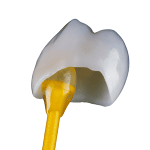 ทำไมต้องครอบฟันประโยชน์ที่คุณอาจไม่เคยรู้