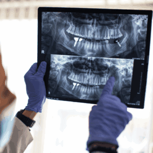 ปัญหาที่อาจเกิดขึ้นกับรากฟันเทียม