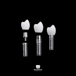 รากฟันเทียม มีทั้งหมดกี่แบบ