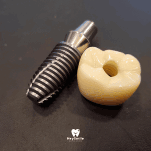 วัสดุที่ใช้ใน รากฟันเทียม