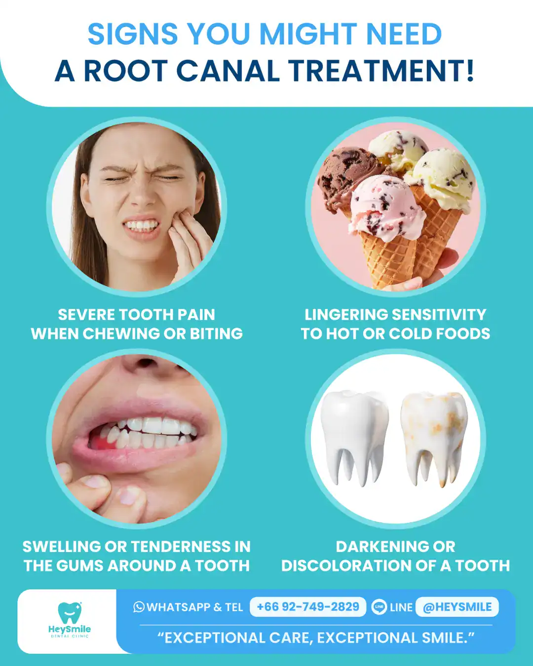 Root Canal Cost in Bangkok