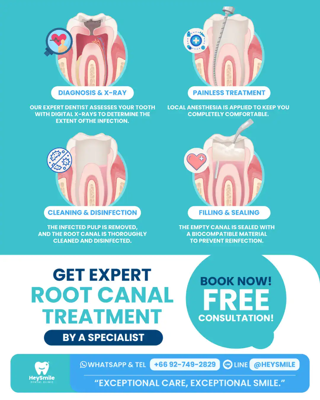 Root Canal Treatment Procedure at HeySmile Dental Clinic
