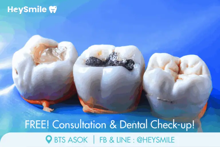 %E0%B9%80%E0%B8%A5%E0%B8%B7%E0%B8%AD%E0%