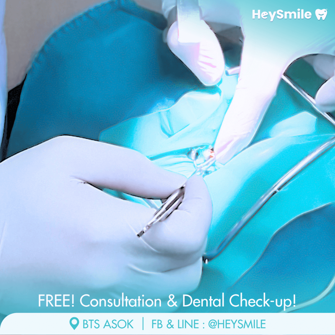 Cleaning and Shaping of Root Canals