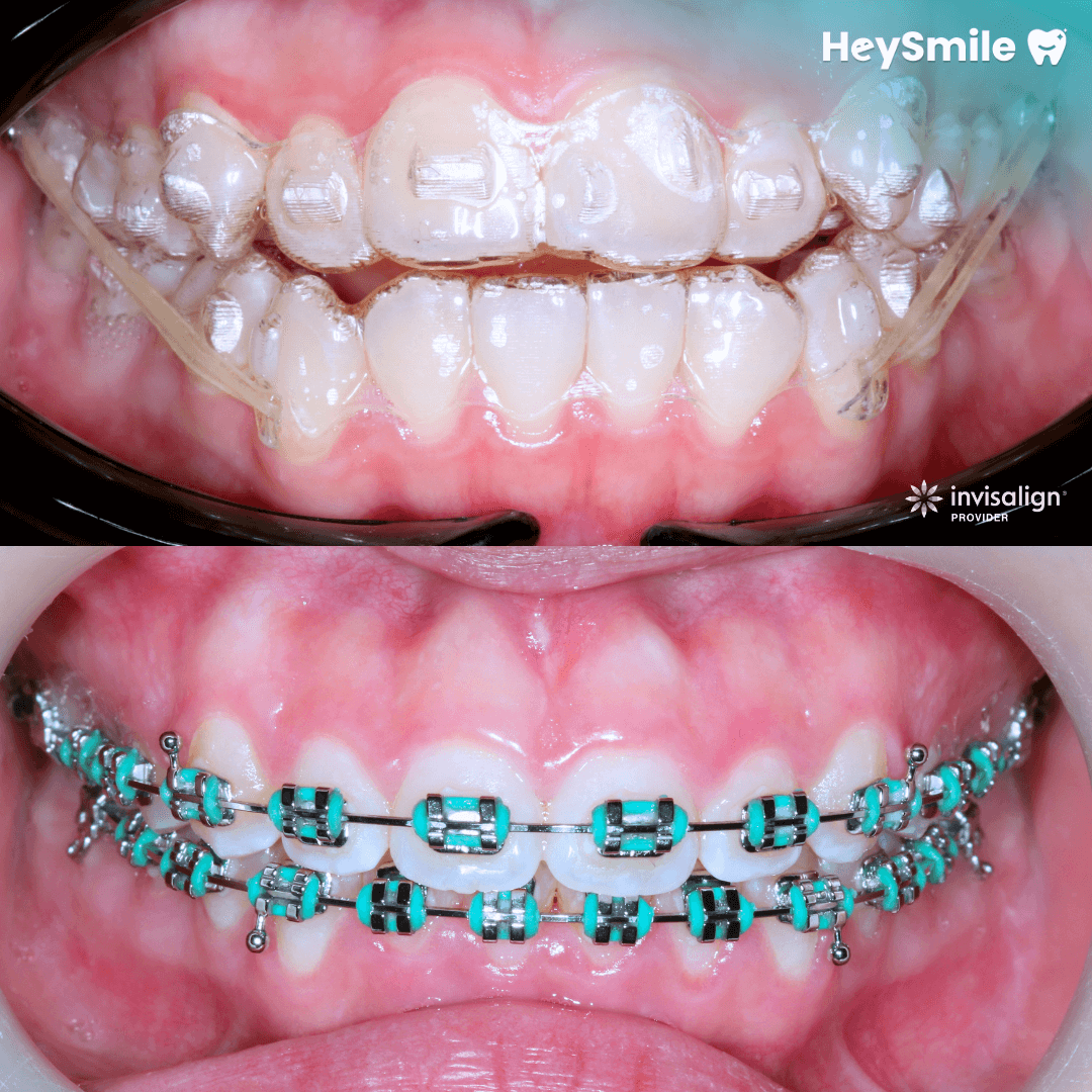 Comprehensive Orthodontic Options