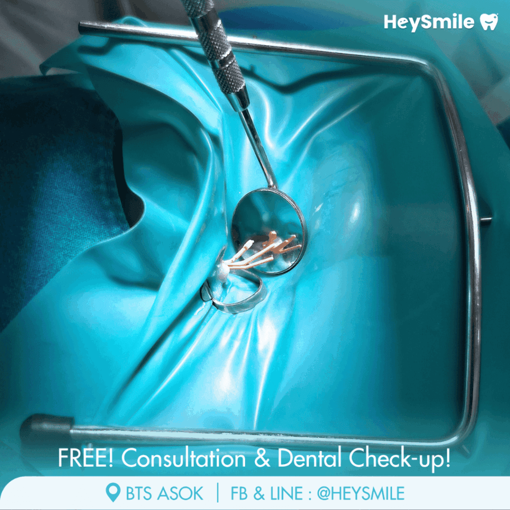 Disinfection and Filling