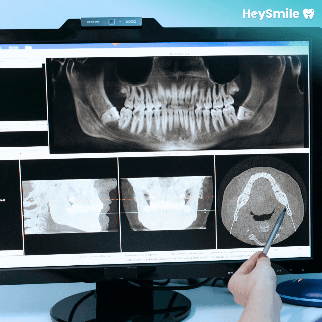 Personalized Orthodontic Planning