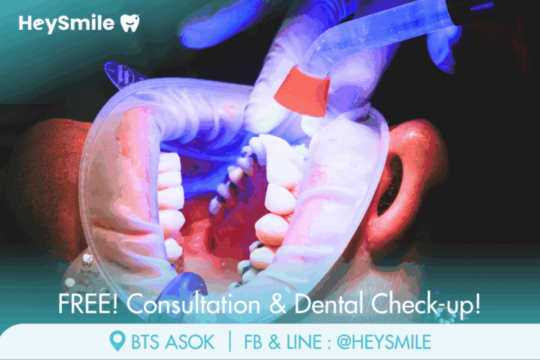 อุดฟันหน้า อุดได้ไหม เห็นรอยหรือเปล่า