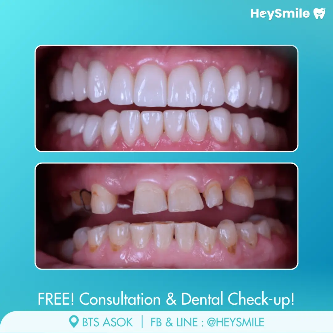 Comprehensive Smile Solutions