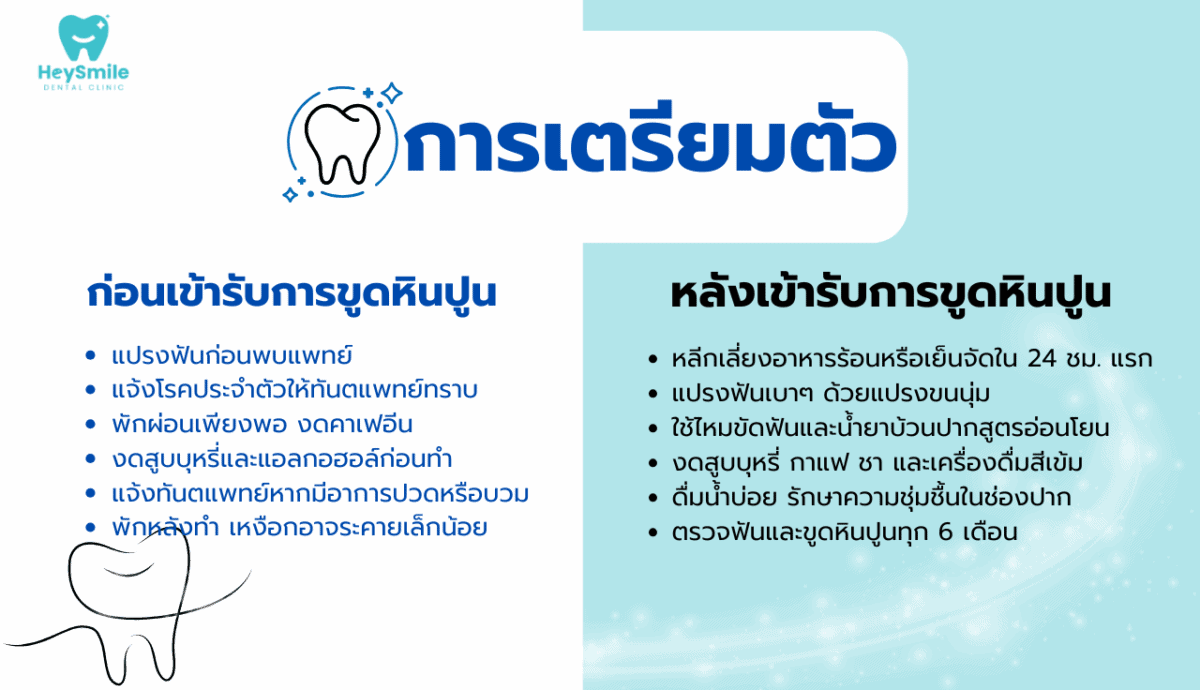 ขูดหินปูน