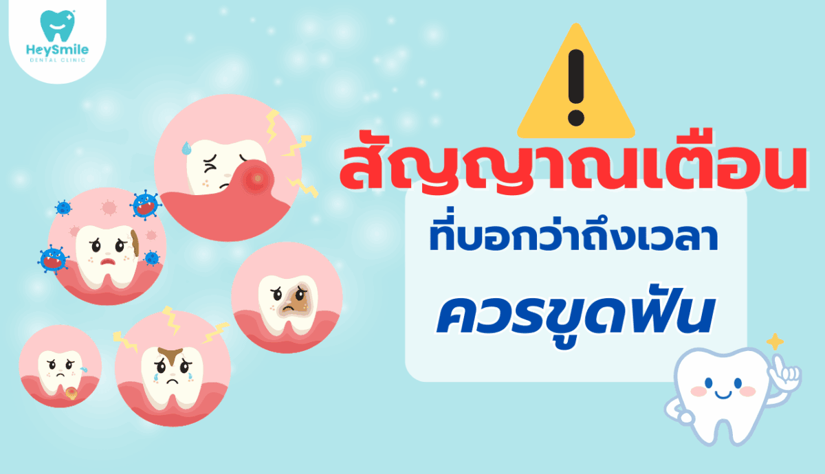 ขูดหินปูน