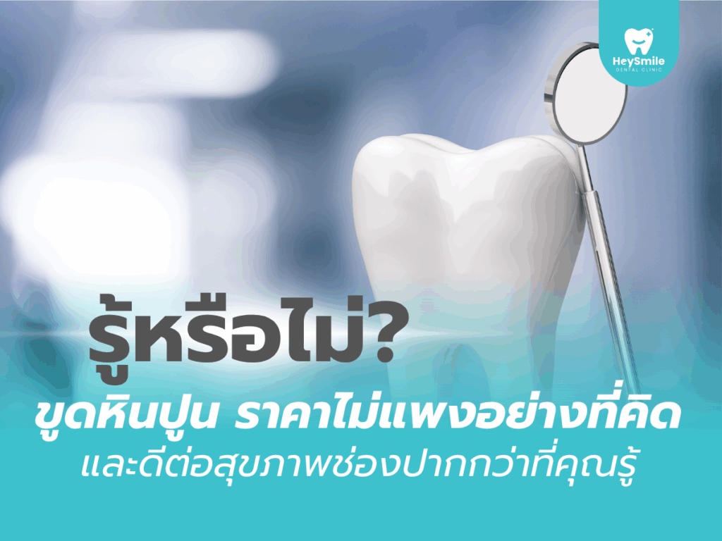 ขูดหินปูน