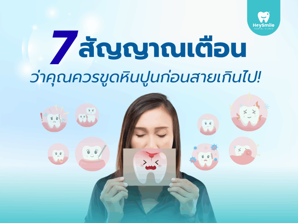 ขูดหินปูน