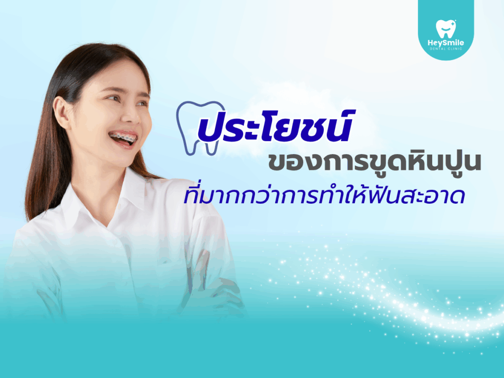 ขูดหินปูน