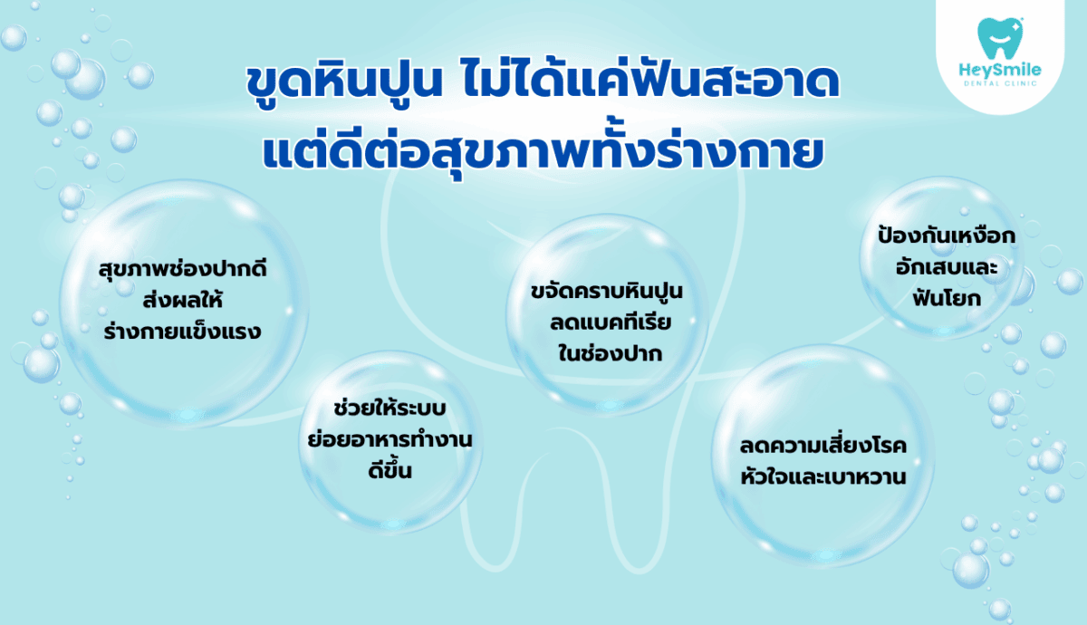 ขูดหินปูน