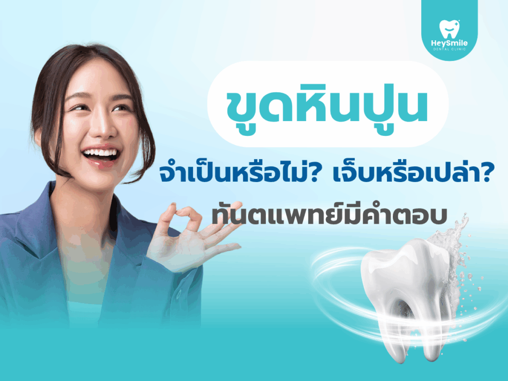 ขูดหินปูน