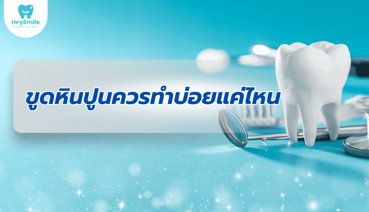 ขูดหินปูน