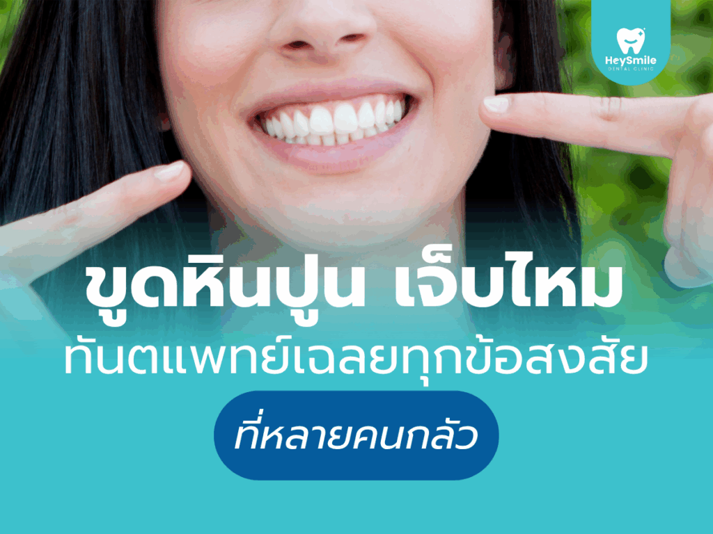 ขูดหินปูน