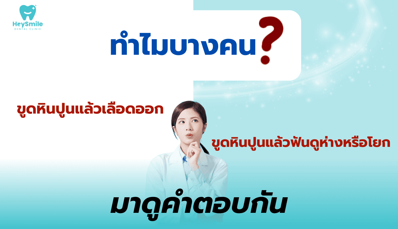 ขูดหินปูน