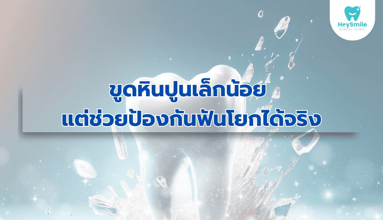 ขูดหินปูน