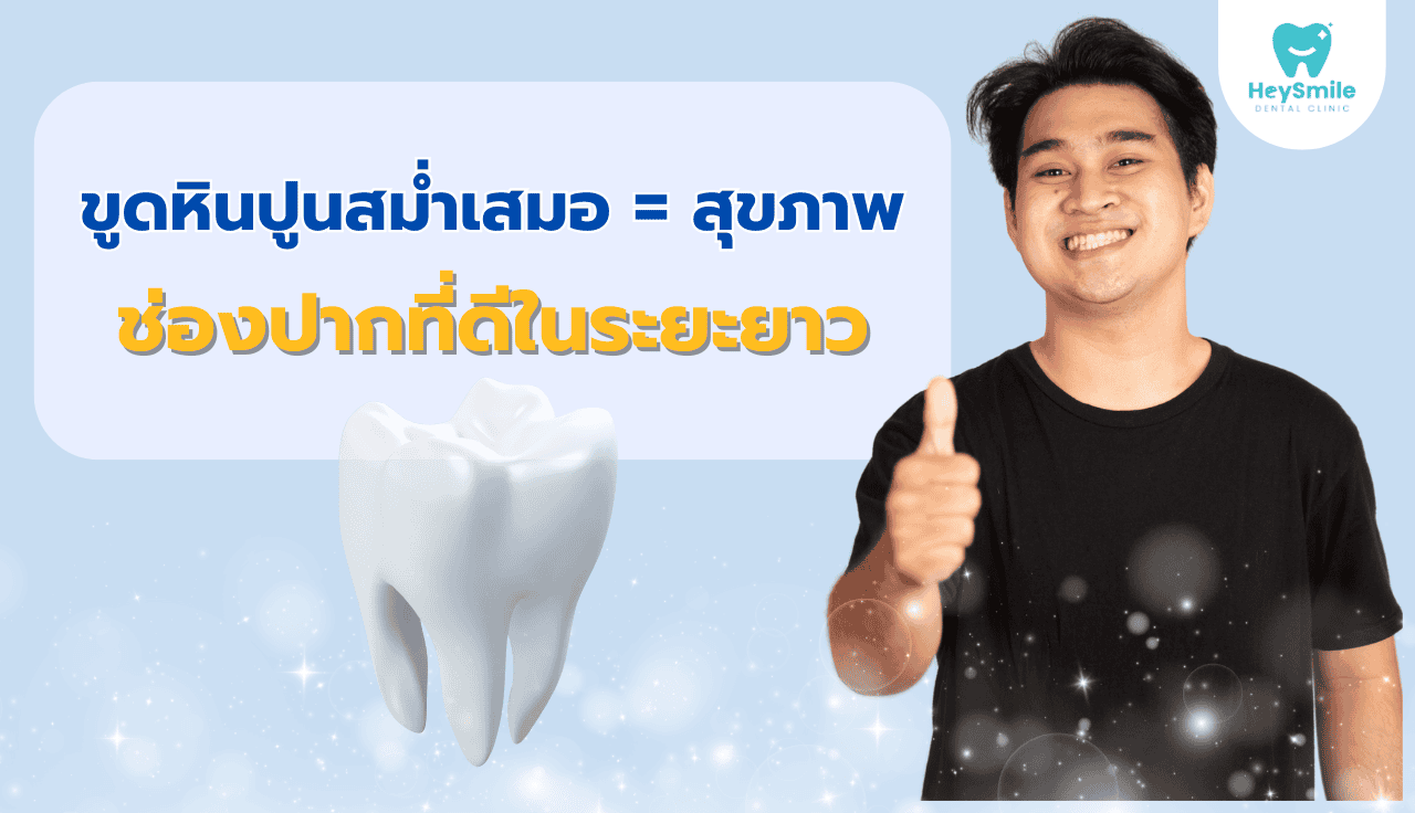 ขูดหินปูน