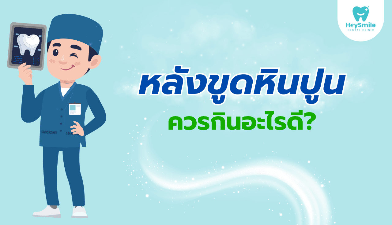 ขูดหินปูน