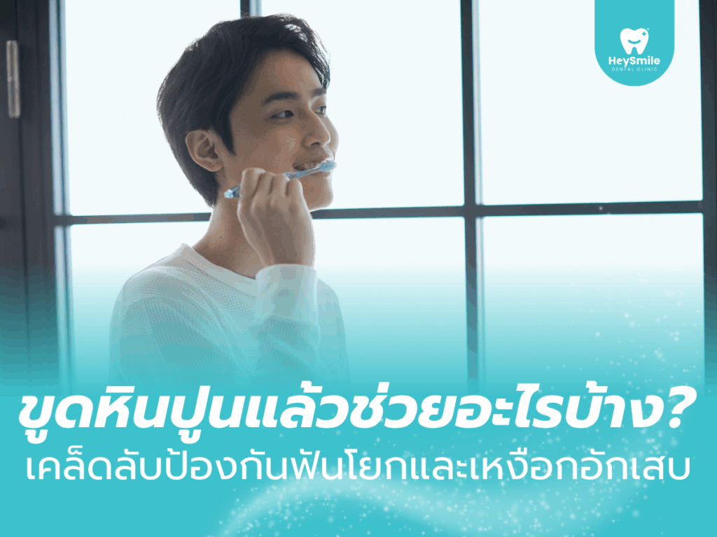 ขูดหินปูน