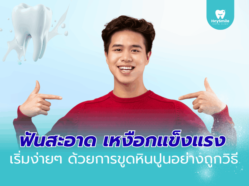 ขูดหินปูน