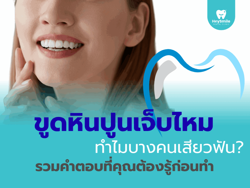 ขูดหินปูน