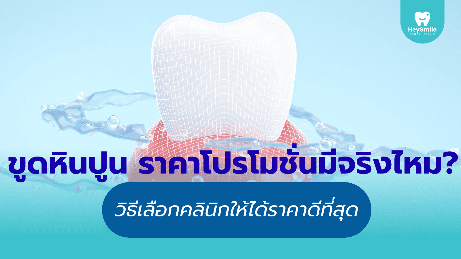 ขูดหินปูน