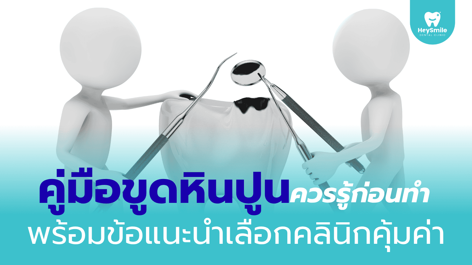 ขูดหินปูน