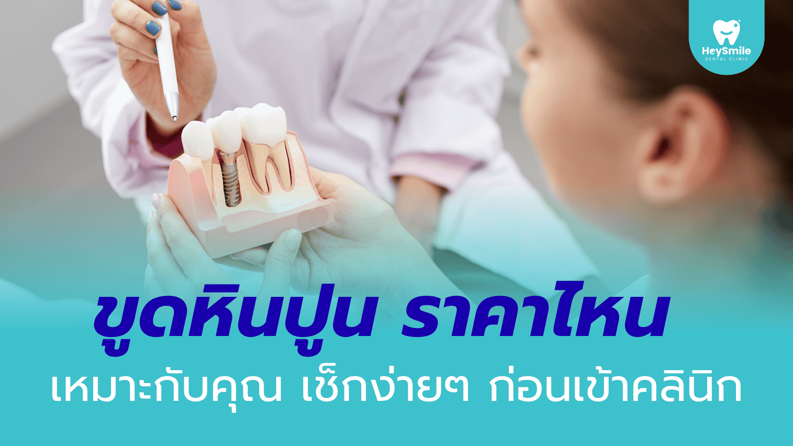 ขูดหินปูน