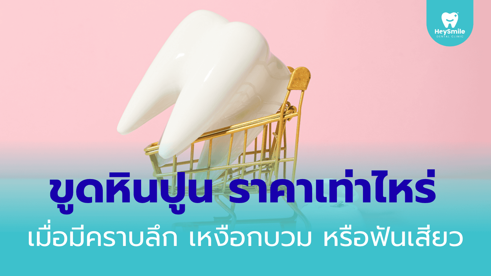 ขูดหินปูน