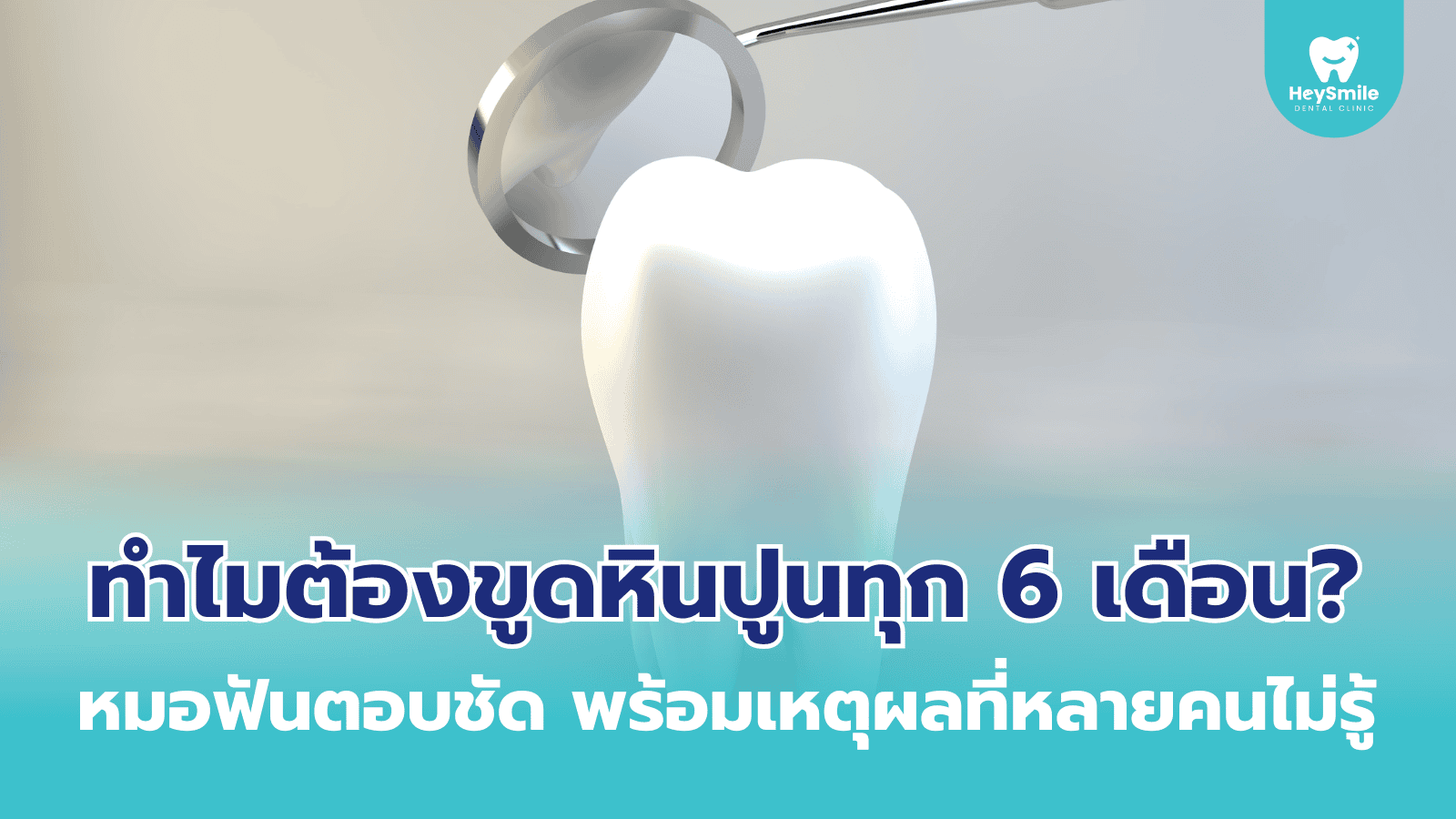 ขูดหินปูน