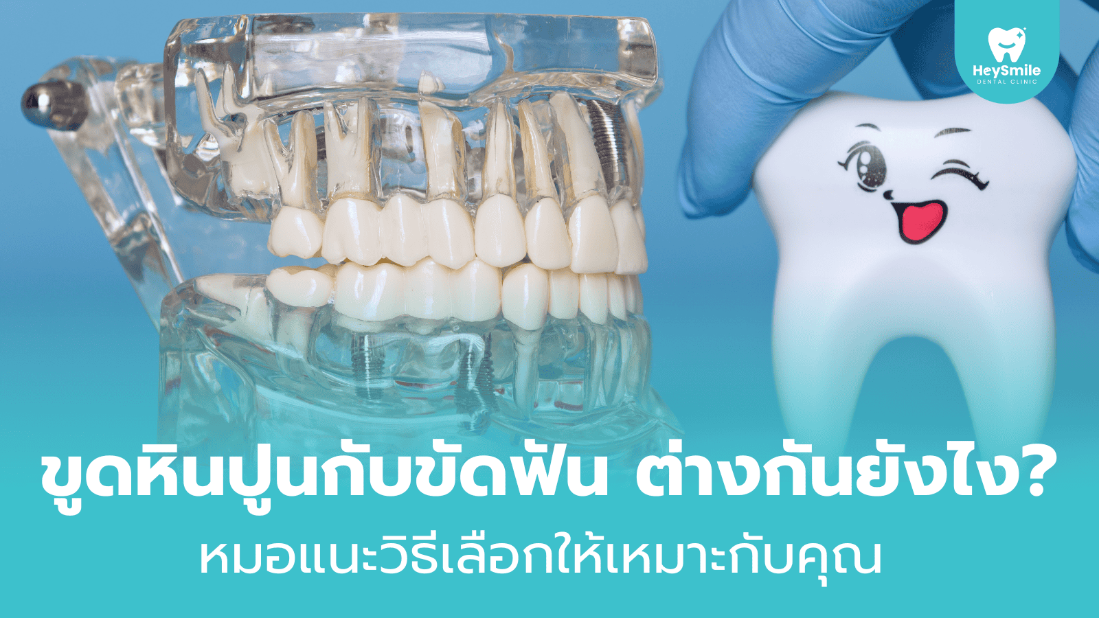 ขูดหินปูน