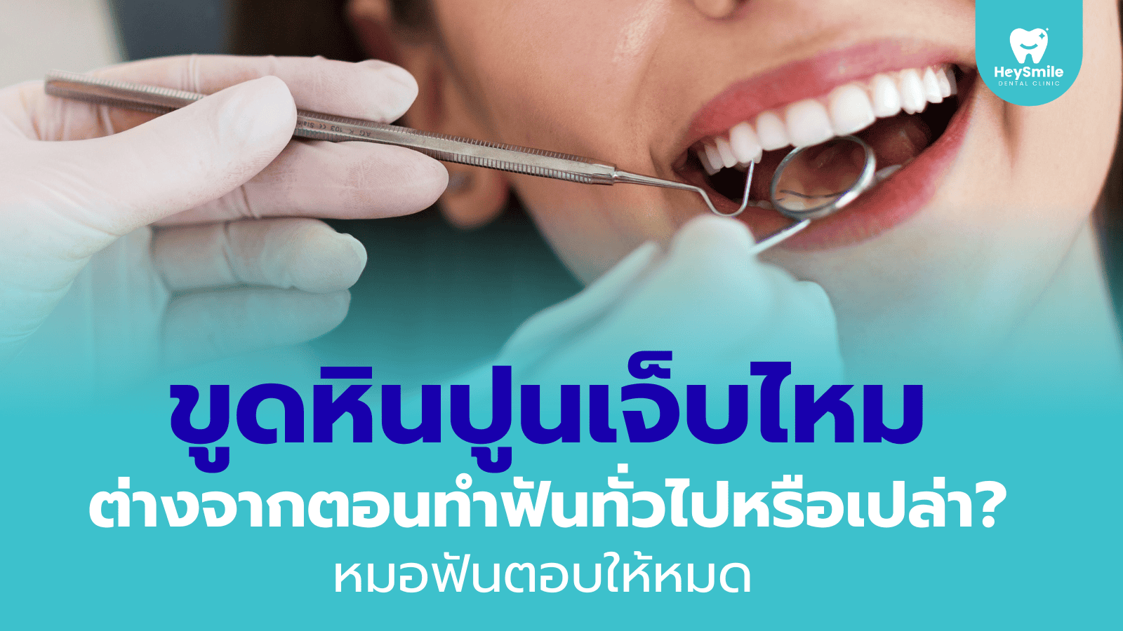 ขูดหินปูน