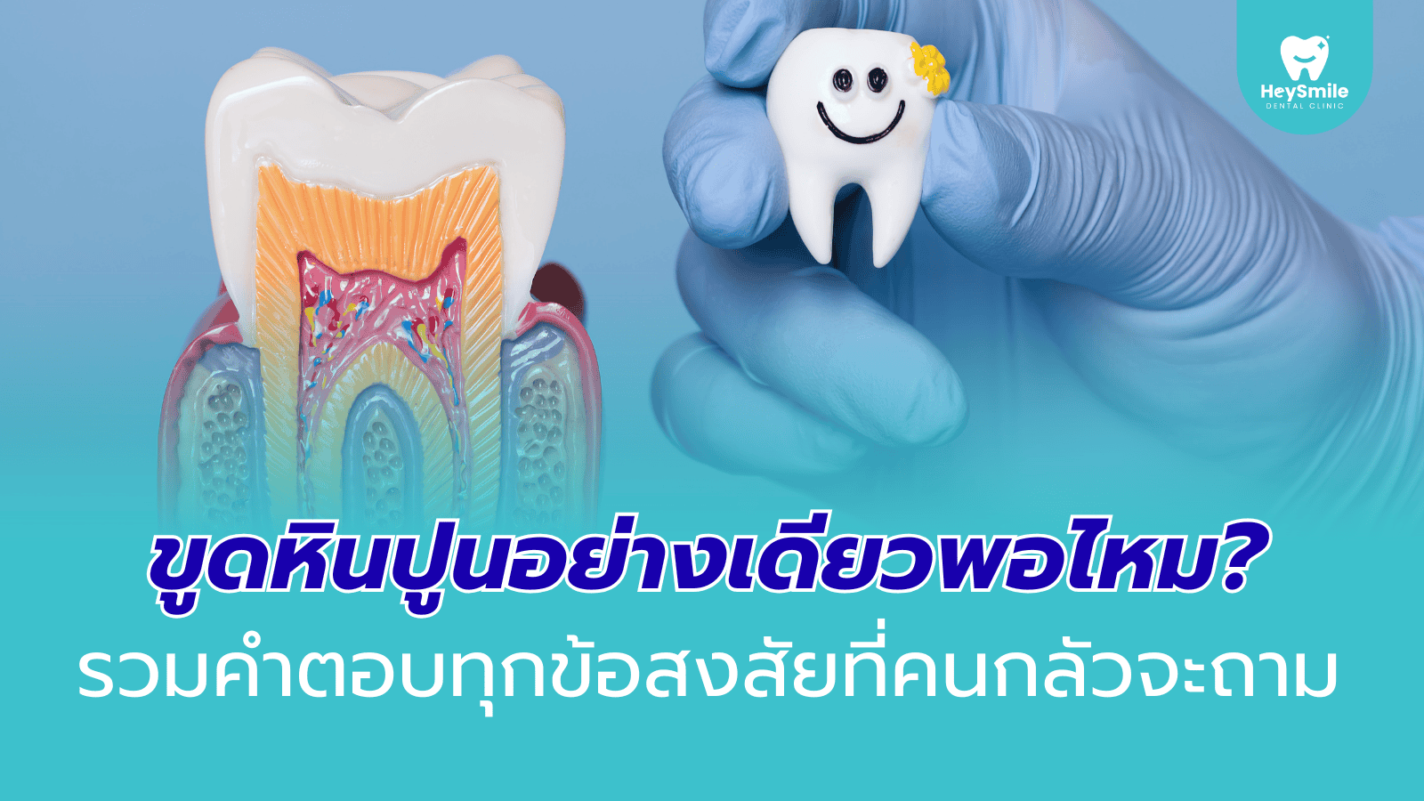 ขูดหินปูน